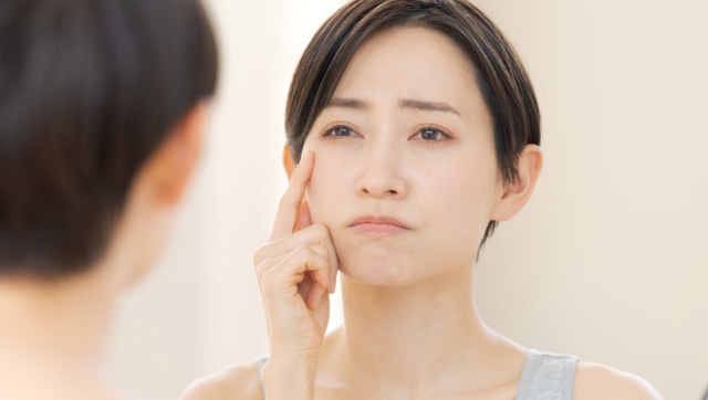 ニキビ・シワなど肌に悩みがある