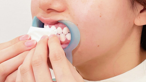 2.歯の水分を拭き取る