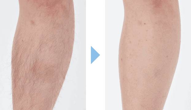 三浦隼人さんの施術結果