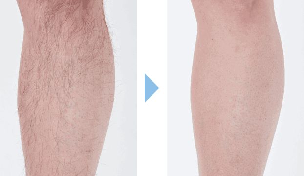 久住直希さんの施術結果