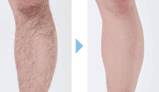 森永昌也さんの施術結果