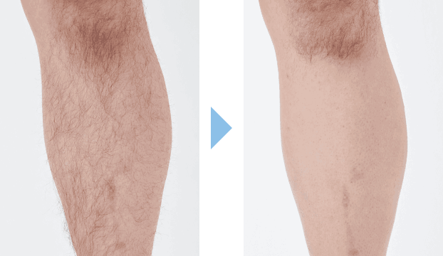 石森智幸さんの施術結果